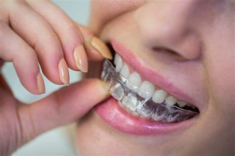 Mgaical teeth braces